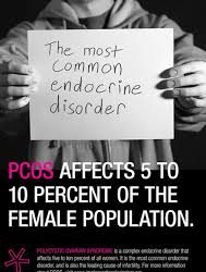 PCOS – The Most Common Hormone Disorder