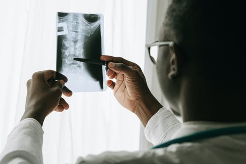 Bone Loss – Osteoporosis Detection