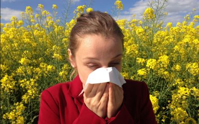 Allergies and Histamine