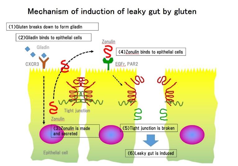Mechanism of induction of Leaky gut 
