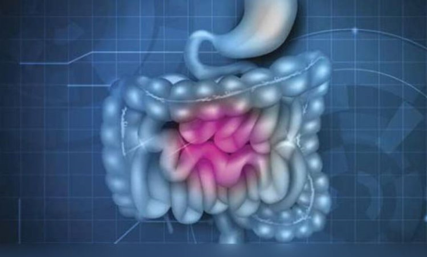Gut and Microbiome Health