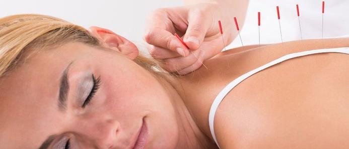 Acupuncture Example