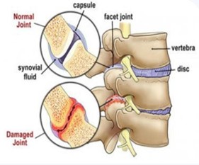 Imbrication in the Vertebrae