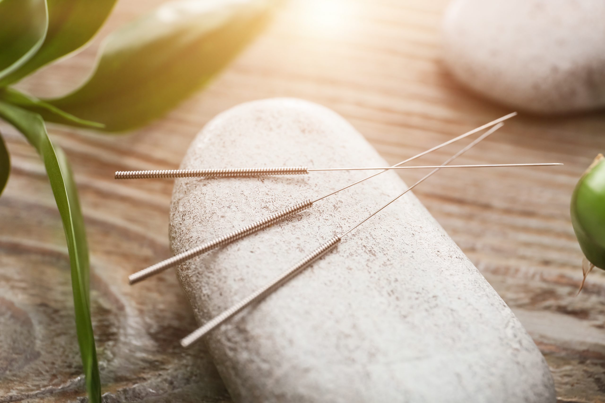 Acupuncture